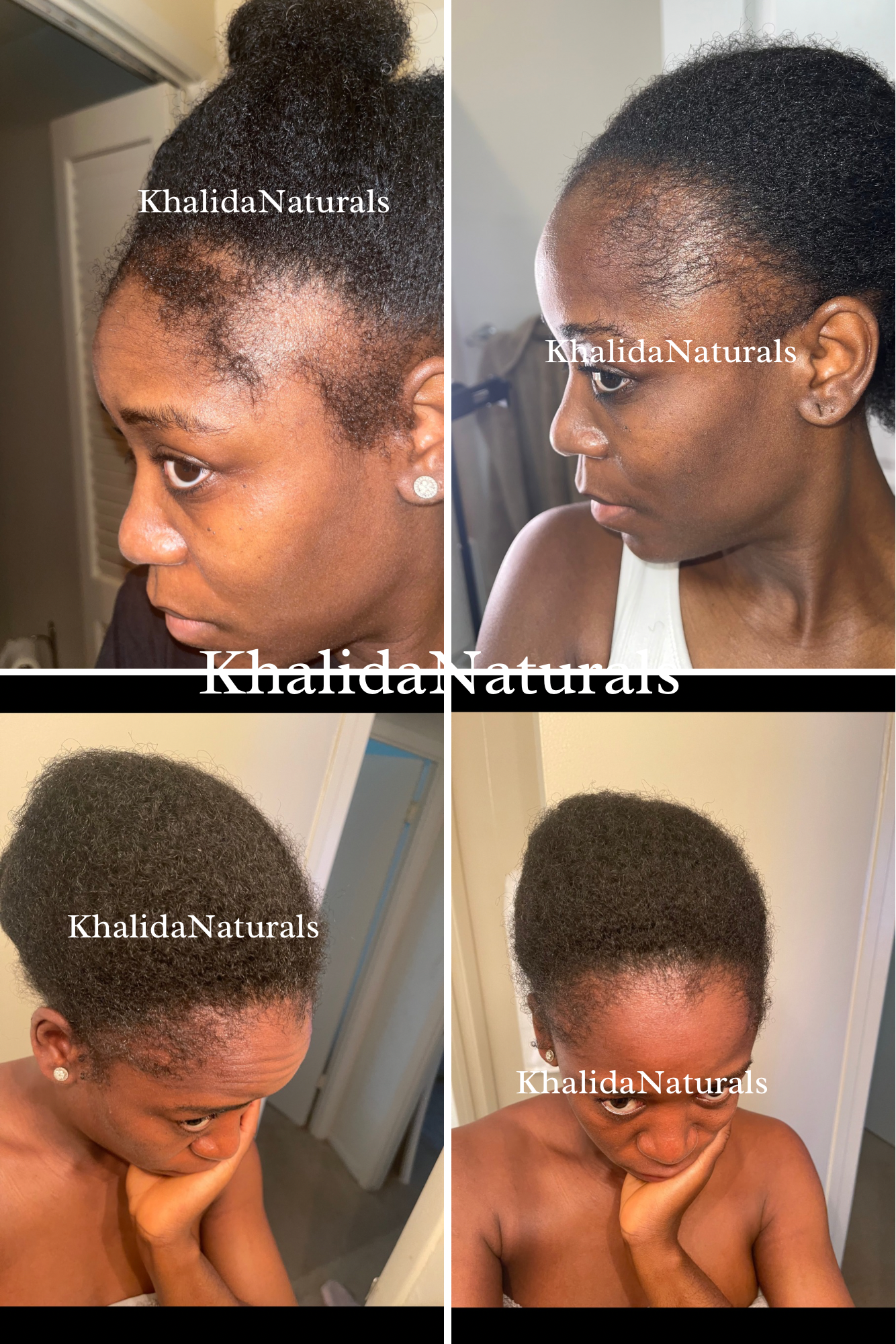 Mega Edge & Hair Growth Grease KhalidaNaturals