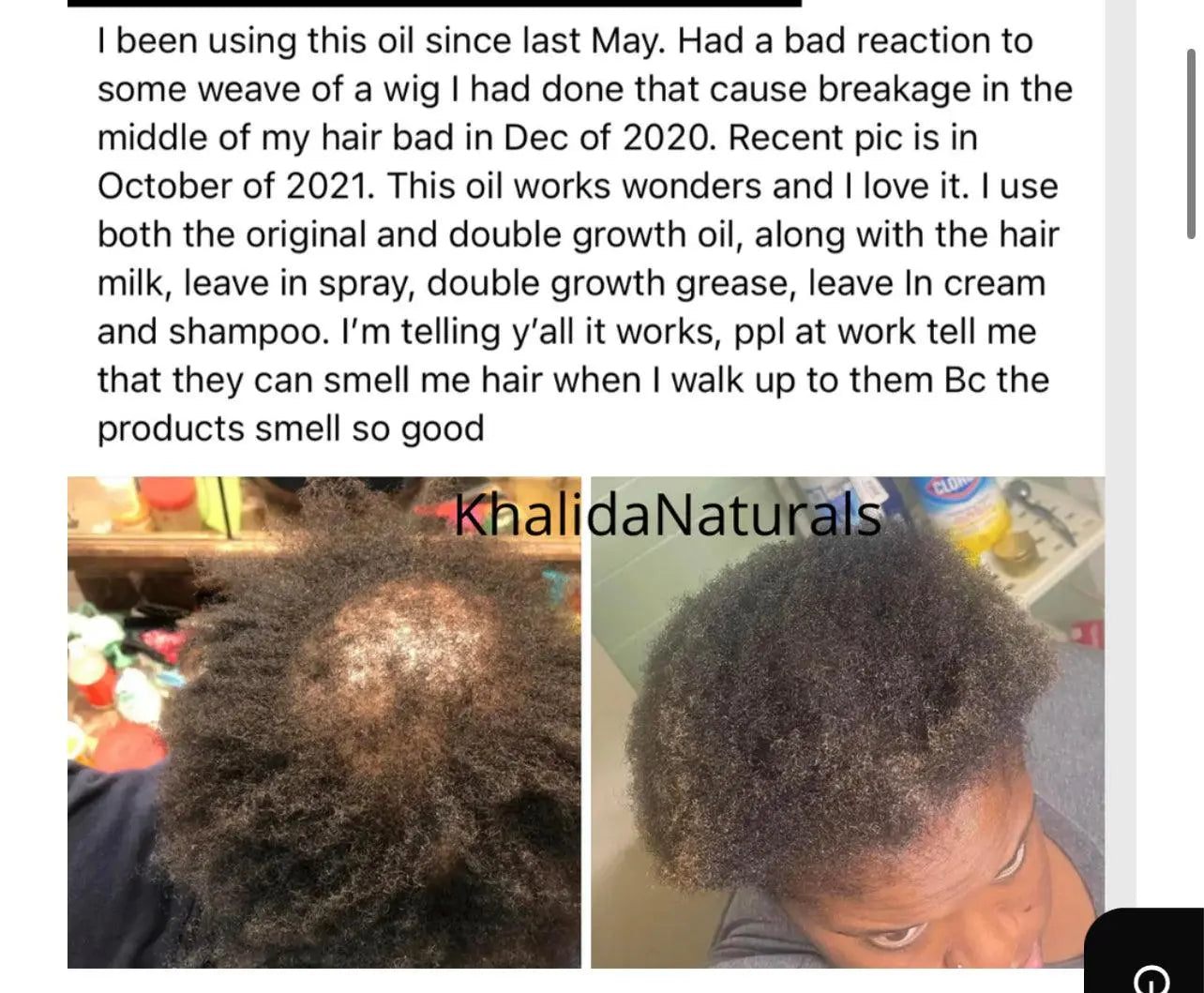 Rosemary + Cayenne Pepper Hair & Beard Growth Oil KhalidaNaturals