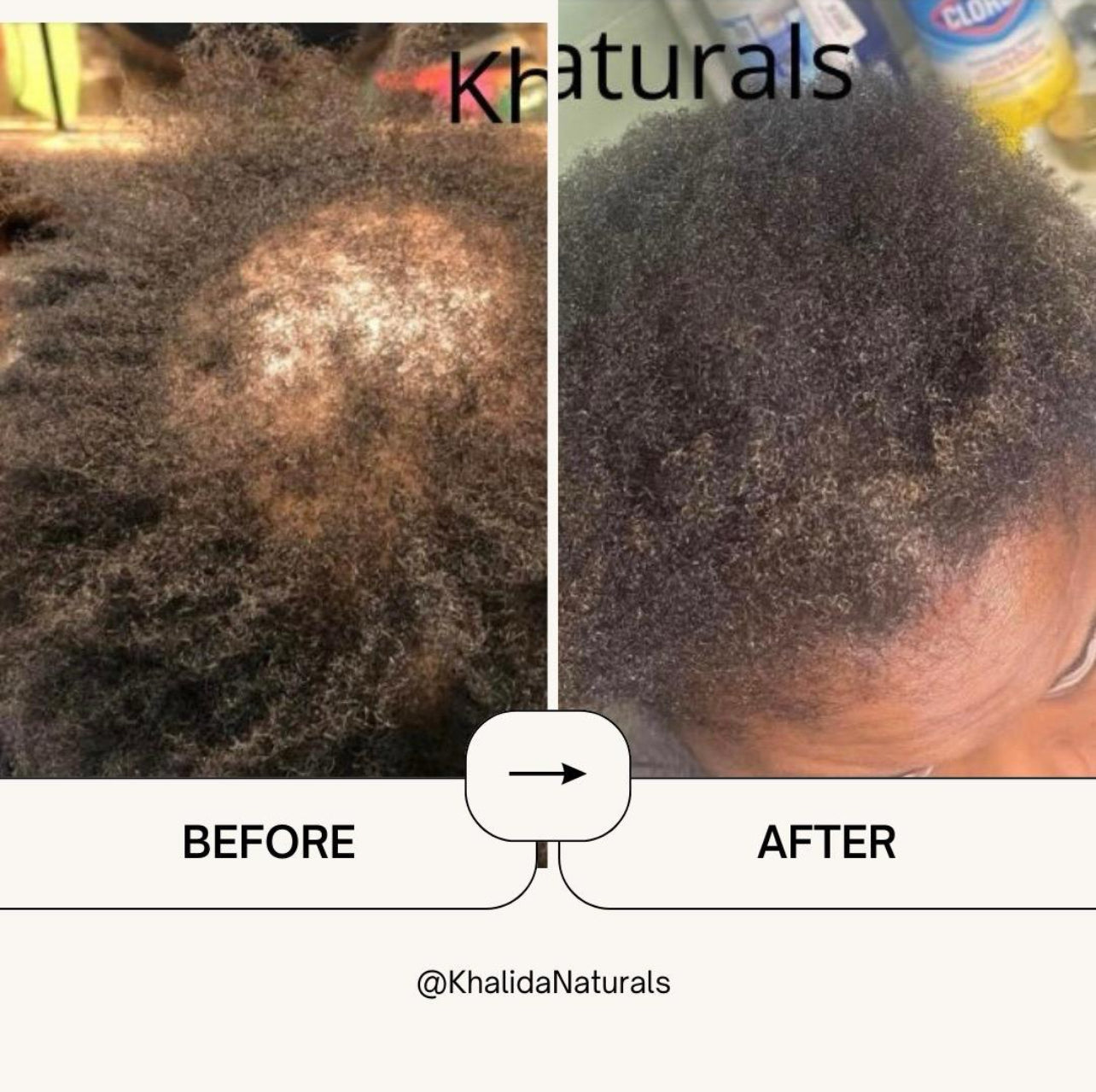 Kinky Hair Growth Oil(West African Batana Oil) KhalidaNaturals