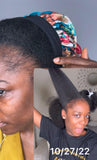 Hair & Edges -*Traction Alopecia*