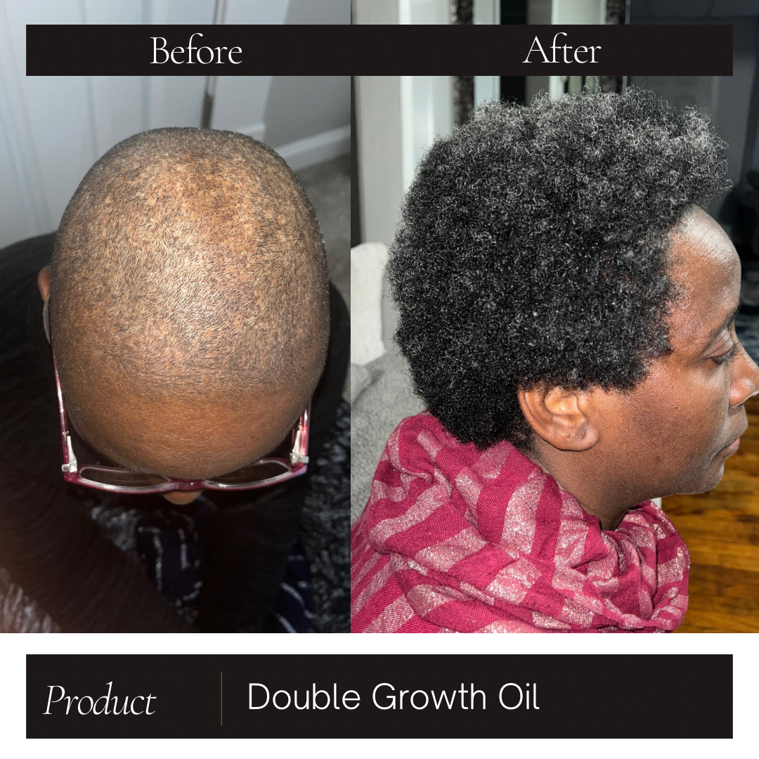 Double Growth Hair + Beard Oil